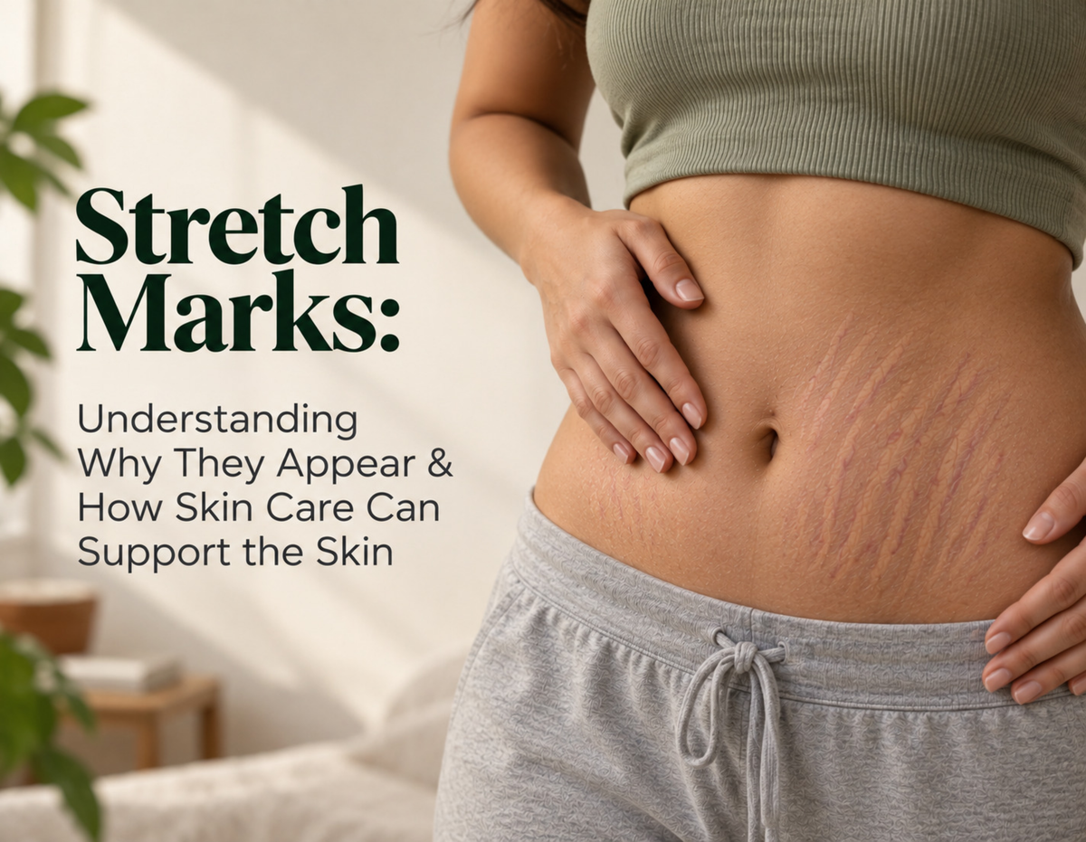 Stretch Marks: Understanding Why They Appear & How Skin Care Can Support the Skin